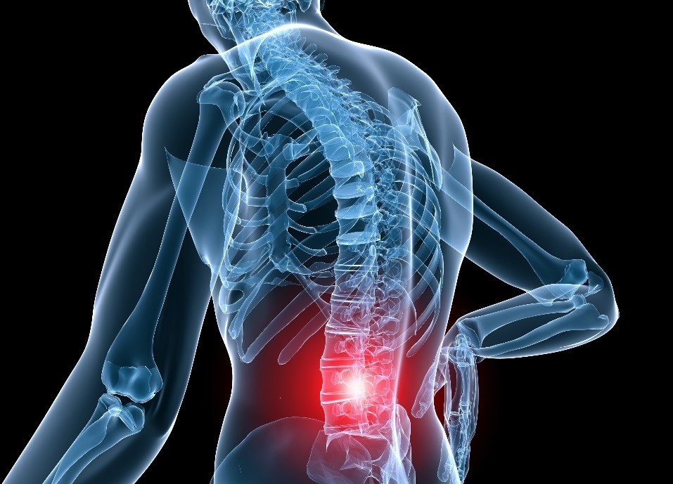 lumbar muscle strain - lower back pain -